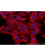PLA2G4E Polyclonal antibody 18088-1-AP proteintech