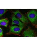 B3GNT3 Polyclonal antibody 18098-1-AP proteintech
