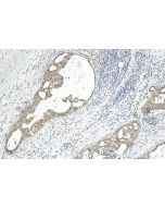 USP37 Polyclonal antibody 18465-1-AP proteintech