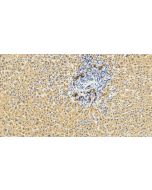 CD133 Polyclonal antibody 18495-1-AP proteintech