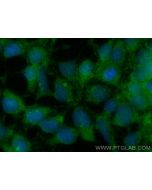 QPCT Polyclonal antibody 18571-1-AP proteintech