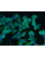 CD117/c-Kit Polyclonal antibody 18696-1-AP proteintech