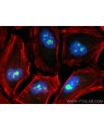 REXO4 Polyclonal antibody 18890-1-AP proteintech