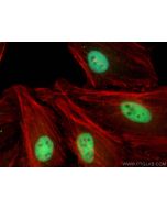 RBM16 Polyclonal antibody 18893-1-AP proteintech