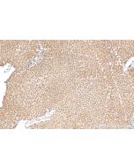 SGMS1 Polyclonal antibody 19050-1-AP proteintech
