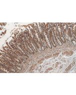 ADHFE1 Polyclonal antibody 19359-1-AP proteintech