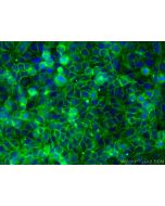 MYOF Polyclonal antibody 19548-1-AP proteintech