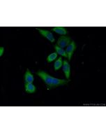 COL4A4 Polyclonal antibody 19674-1-AP proteintech