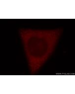 RRM1 Polyclonal antibody 19686-1-AP proteintech
