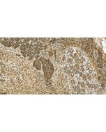 CYP4F3 Polyclonal antibody 19701-1-AP proteintech
