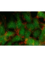Huntingtin Polyclonal antibody 19957-1-AP proteintech