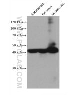 Alpha smooth muscle actin specific Monoclonal antibody Proteintech  67735-1-Ig