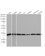 HPRT Polyclonal antibody Proteintech  15059-1-AP