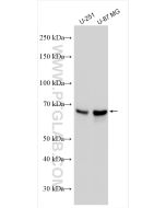 MMP2 Monoclonal antibody Proteintech  66366-1-Ig