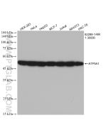 ATP5A1 Recombinant monoclonal antibody Proteintech  82288-1-RR