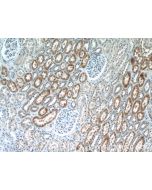 CYP4F8 Polyclonal antibody 20011-1-AP proteintech