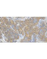 SLC43A3 Polyclonal antibody 20131-1-AP proteintech