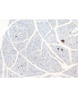 GPR81 Polyclonal antibody 20146-1-AP proteintech