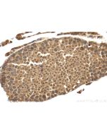 POTEB-Specific Polyclonal antibody 20205-1-AP proteintech