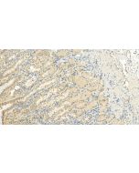GPRIN3-Specific Polyclonal antibody 20212-1-AP proteintech