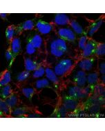 RAB11A Polyclonal antibody 20229-1-AP proteintech