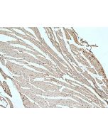 SCN7A-Specific Polyclonal antibody 20256-1-AP proteintech