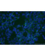 SLC13A4 Polyclonal antibody 20302-1-AP proteintech