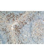 GPR171 Polyclonal antibody 20307-1-AP proteintech