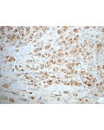 SUZ12 Polyclonal antibody 20366-1-AP proteintech