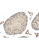 KBTBD4 Polyclonal antibody 20428-1-AP proteintech