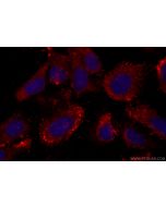 FBXW9 Polyclonal antibody 20464-1-AP proteintech
