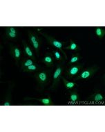 TOP2B Polyclonal antibody 20549-1-AP proteintech