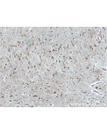 IIP45 Polyclonal antibody 20630-1-AP proteintech