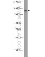 UBF1 Polyclonal antibody 20660-1-AP proteintech