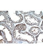 SDF2L1 Polyclonal antibody 20888-1-AP proteintech