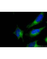 SEC23IP Polyclonal antibody 20892-1-AP proteintech