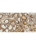 HIF-1 alpha Polyclonal antibody, PBS Only 20960-1-PBS proteintech