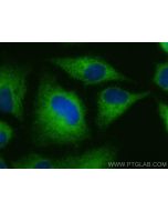 TRIM46 Polyclonal antibody 21026-1-AP proteintech