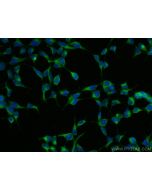 UBXD2 Polyclonal antibody 21052-1-AP proteintech