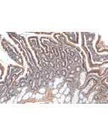 C19orf45 Polyclonal antibody 21060-1-AP proteintech