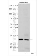 LHFPL4 Polyclonal antibody 21094-1-AP proteintech