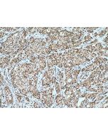 TOX2 Polyclonal antibody 21162-1-AP proteintech