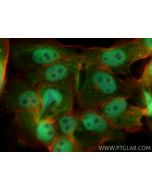 MKL1/MRTF-A Polyclonal antibody 21166-1-AP proteintech