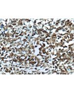 BCL6 Polyclonal antibody 21187-1-AP proteintech