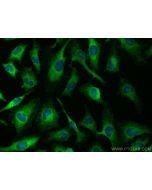 ERC2 Polyclonal antibody 21396-1-AP proteintech