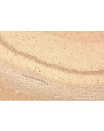 IGSF21 Polyclonal antibody 21465-1-AP proteintech