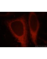 CHIA Polyclonal antibody 21484-1-AP proteintech