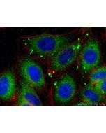 CYP26B1 Polyclonal antibody 21555-1-AP proteintech