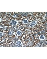 SUGCT Polyclonal antibody 21589-1-AP proteintech