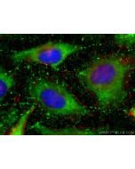 RPLP1 Polyclonal antibody 21636-1-AP proteintech